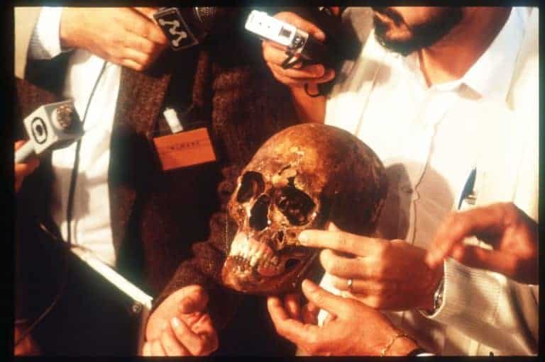 The Body Of Mengele - The purported skull of Josef Mengele is on display for reporters and news crews June 6, 1985 in Embu, Brazil. It is believed that notorious Nazi death-camp doctor Josef Mengele's bones were unearthed in a small cemetery in Brazil under a grave marker labeled Wolfgang Gerhard. (Photo by Robert Nickelsberg/Liaison)