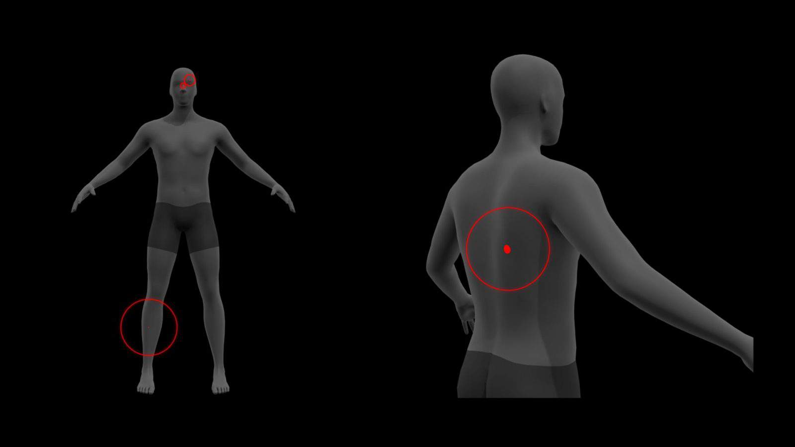 3D model with injuries and text - Visualization of al-Arab’s injuries listed in the medical report.