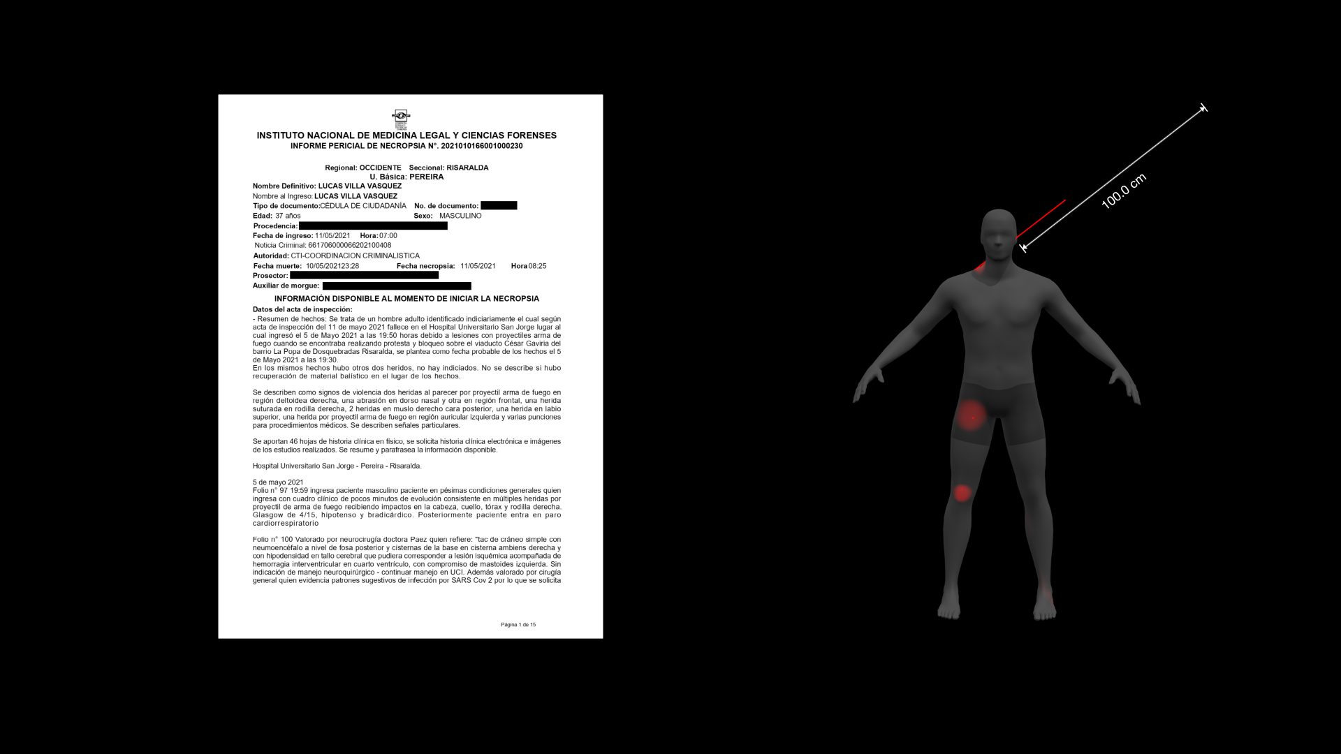 Analysis of the Autopsy - The autopsy indicates Lucas died from a shot fired within 100cm from his head—possibly as an execution shot.