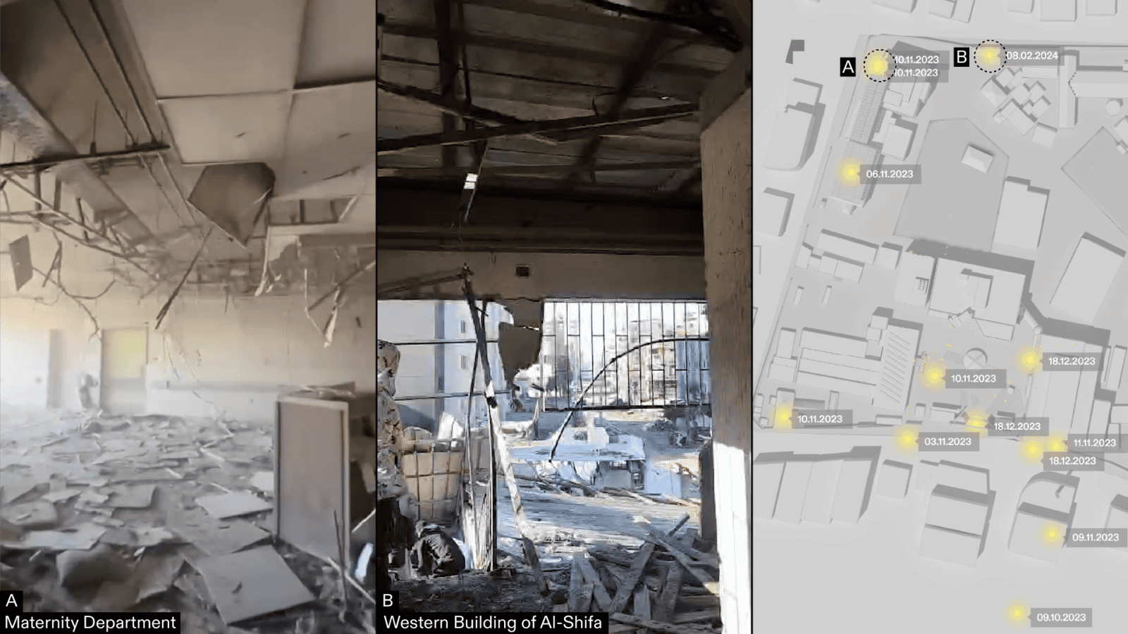 ICJ_Figure_15 - Figure 15: Heavy damage at Al-Shifa buildings after Israeli attacks. Right image from ‘Gaza Hospital Platform’, Forensic Architecture. Left image source: Saleh al-Jafarawi via The New York Times. Left image source: Ismail Alghoul. Composite illustration by Forensic Architecture.